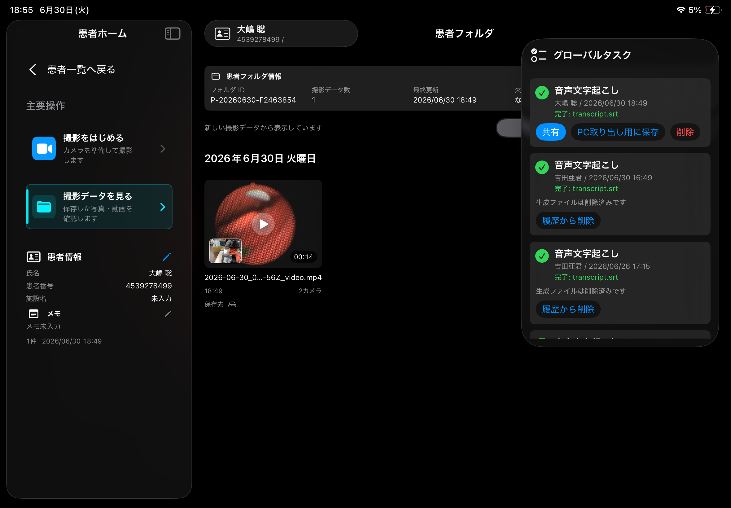 音声文字起こし完了後のグローバルタスク